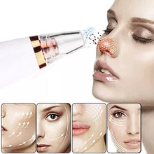 Load image into Gallery viewer, Pore ​​vacuum cleaner
